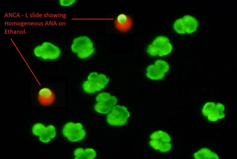 ANCA-L Ethanol